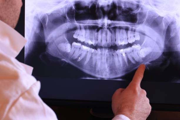 Best Emergency Dental Care for Broken or Chipped Teeth in Evansville, WY