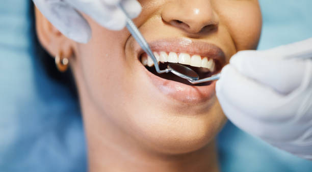 Best Same-Day Emergency Dental Services in Evansville, WY