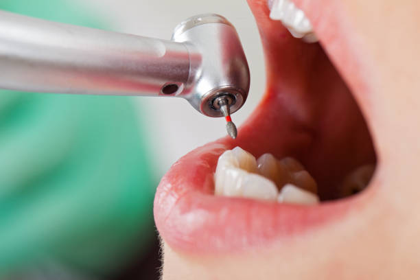 Best Emergency Denture Repair in Evansville, WY